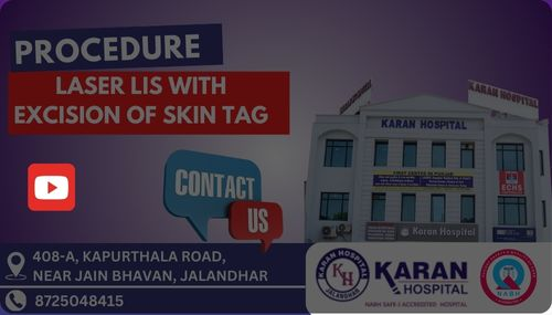 Laser Treatment Video